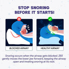 ZEE™ Ergonomic Anti-Snore Pillow | Sleep Specialist Designed