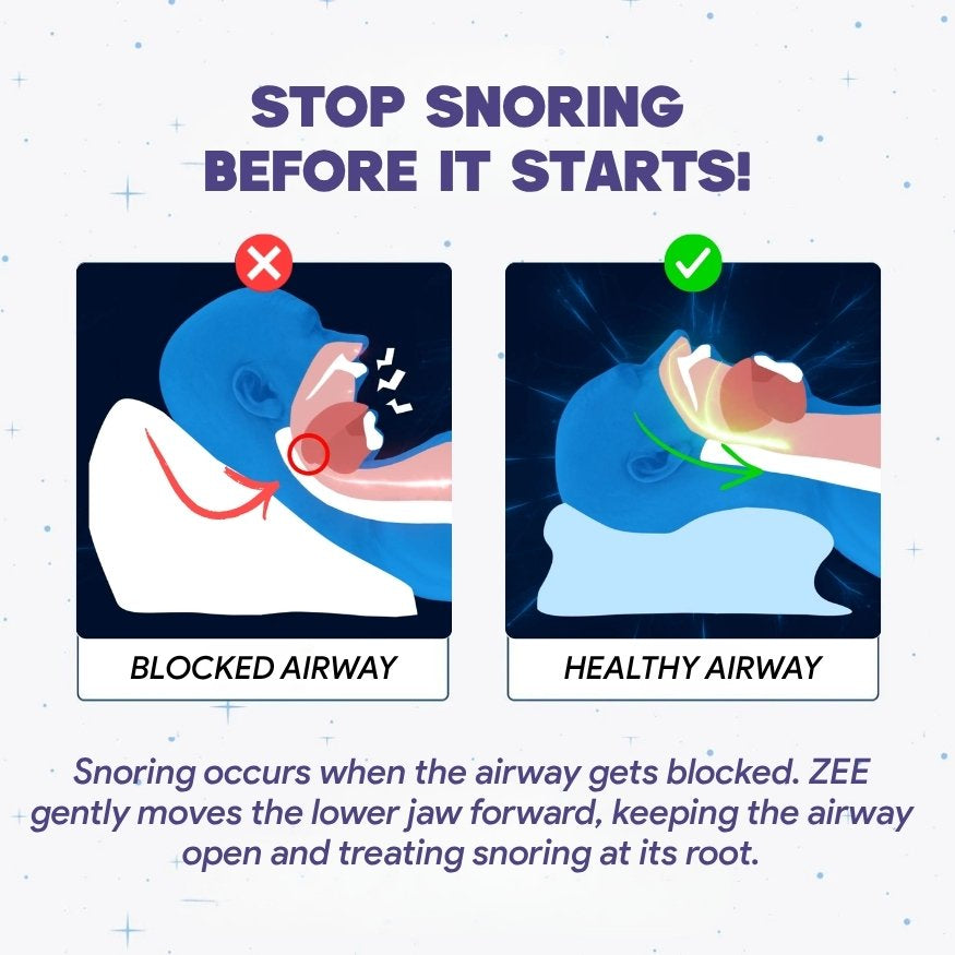 ZEE™ Ergonomic Anti-Snore Pillow | Sleep Specialist Designed